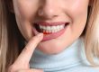 gum care month Dr. Brandon Dever DDS. North Auburn Dentistry. General, Cosmetic, Restorative, Preventative Family Dentistry Dentist dentist in Auburn CA 95603