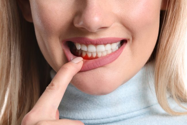 gum care month Dr. Brandon Dever DDS. North Auburn Dentistry. General, Cosmetic, Restorative, Preventative Family Dentistry Dentist dentist in Auburn CA 95603