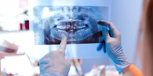 oral surgery auburn oral surgery auburn