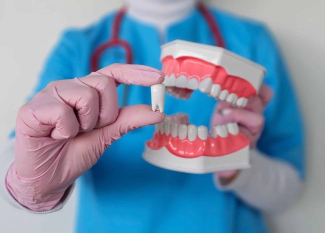 Dentist,Demonstrating,Dental,Implant,Using,Model,Teeth,In,Clinical,Environment what can you eat after removal of wisdom teeth